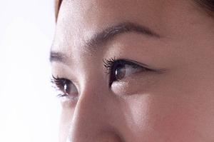 レーザー治療をしている東京のクリニック