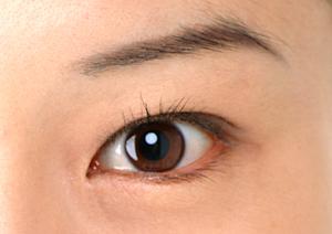 心斎橋の美容クリニックでたるみを治そう